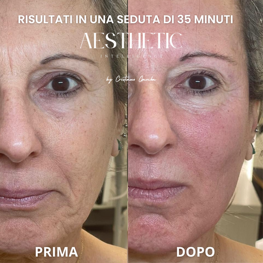🌞 After Glow™ – Il trattamento viso professionale per rigenerare la pelle dopo il sole