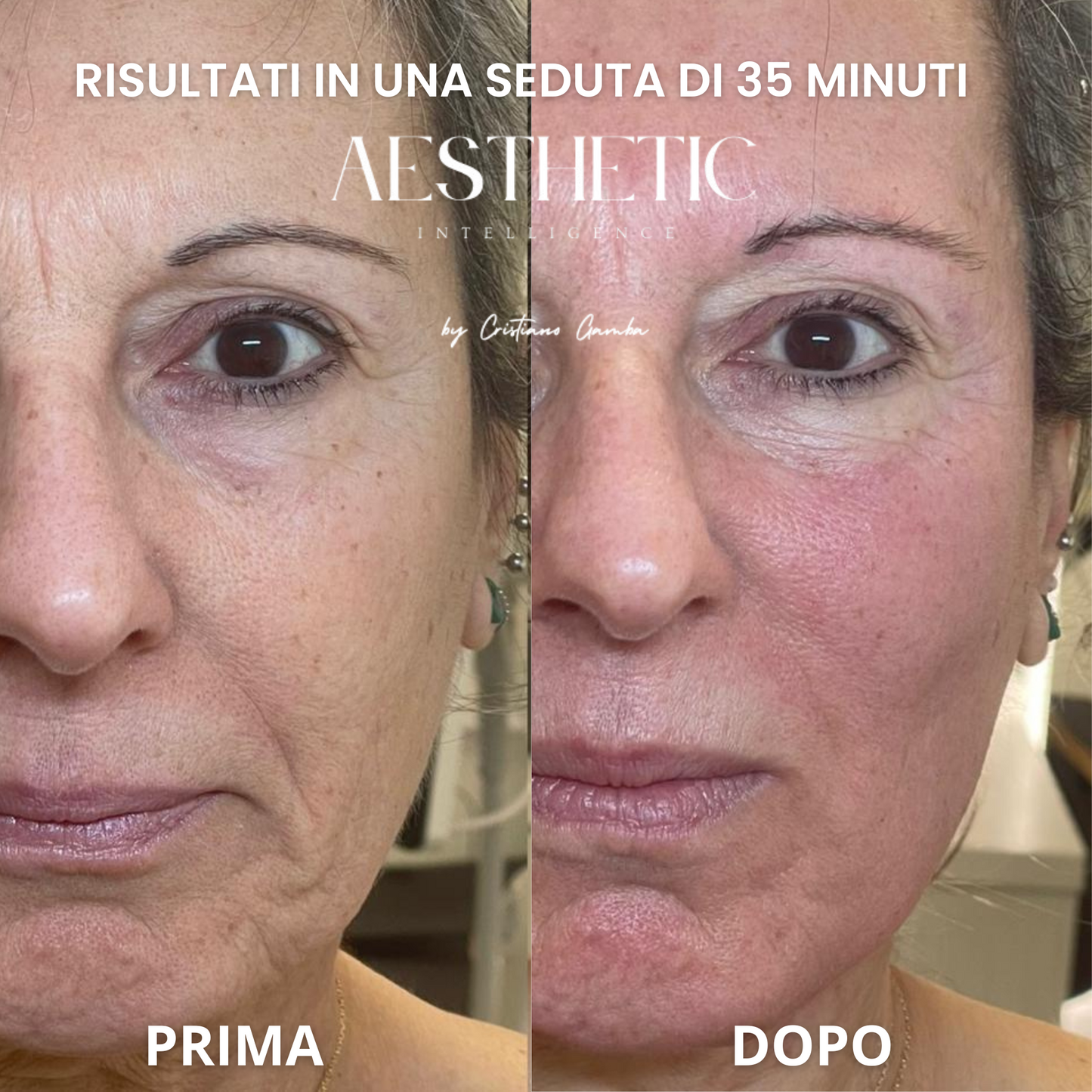 After Glow™ – Protocollo Viso Lenitivo & Riparatore POST-SUN
